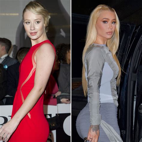 The evolution of Iggy Azalea’s bum